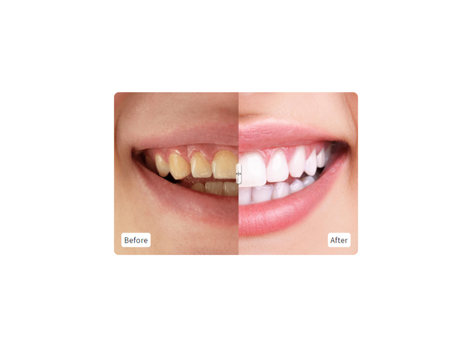 Before and after image slider